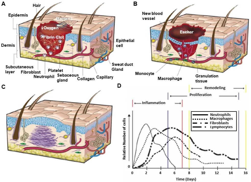 Cross-sectional diagrams of skin through the stages of wound healing—fibrin clot, eschar and granulation tissue, and remodeling—paired with a graph of neutrophil, macrophage, fibroblast, and lymphocyte populations across the inflammation, proliferation, and remodeling phases.