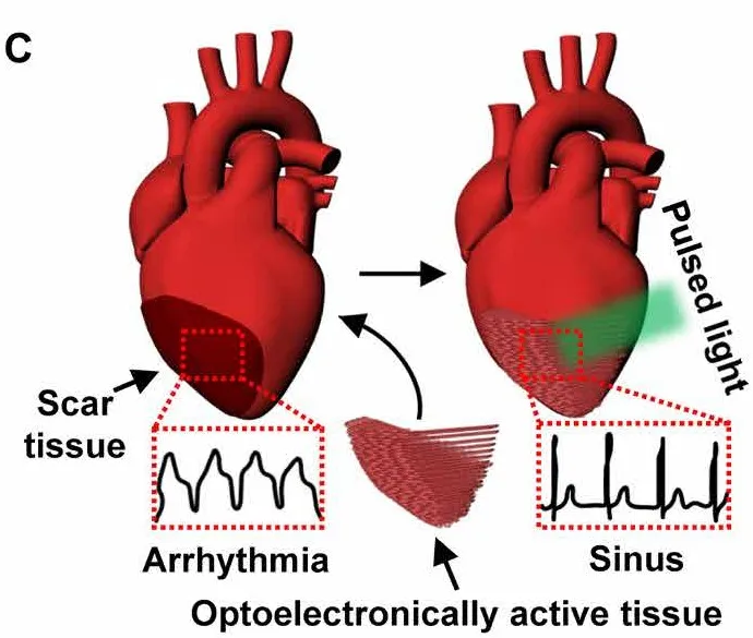 Published Figure 1c showing optoelectronically active tissue restoring sinus rhythm in a scarred-heart model.